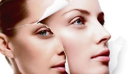 - procedures for non-surgical rejuvenation