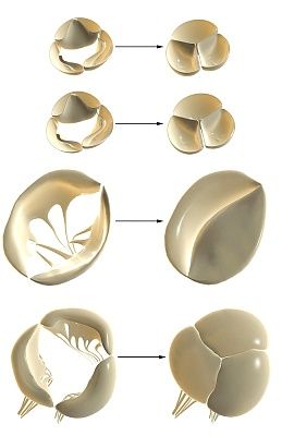 How the heart valves are arranged - the state of rest and contraction