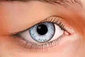 Blepharhalasis Causes Symptoms Treatment Competently About Health On Ilive