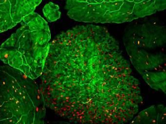 Scientists on the verge of creating oral vaccines for intestinal diseases